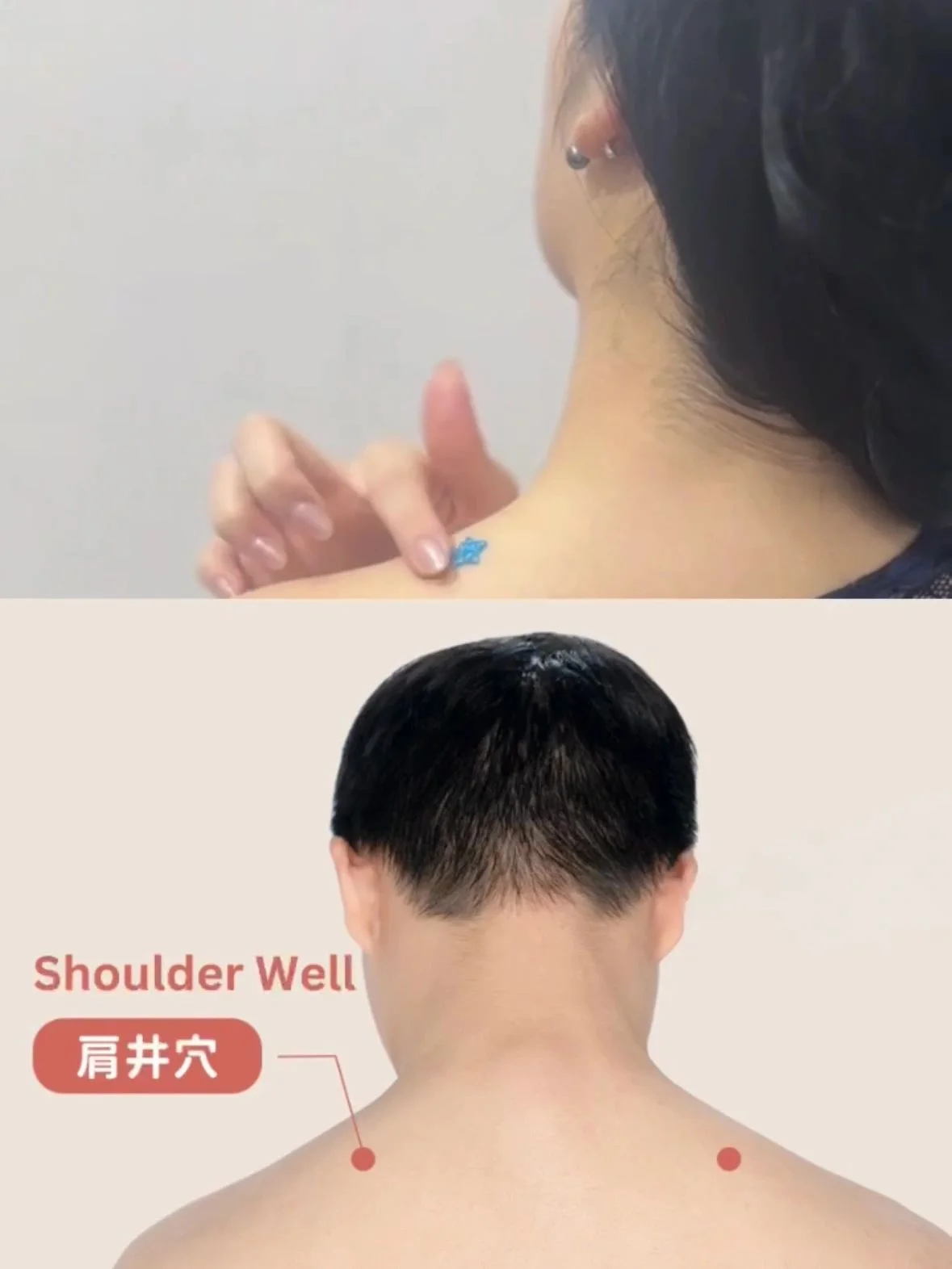 1. “Shoulder Well” Acupoint