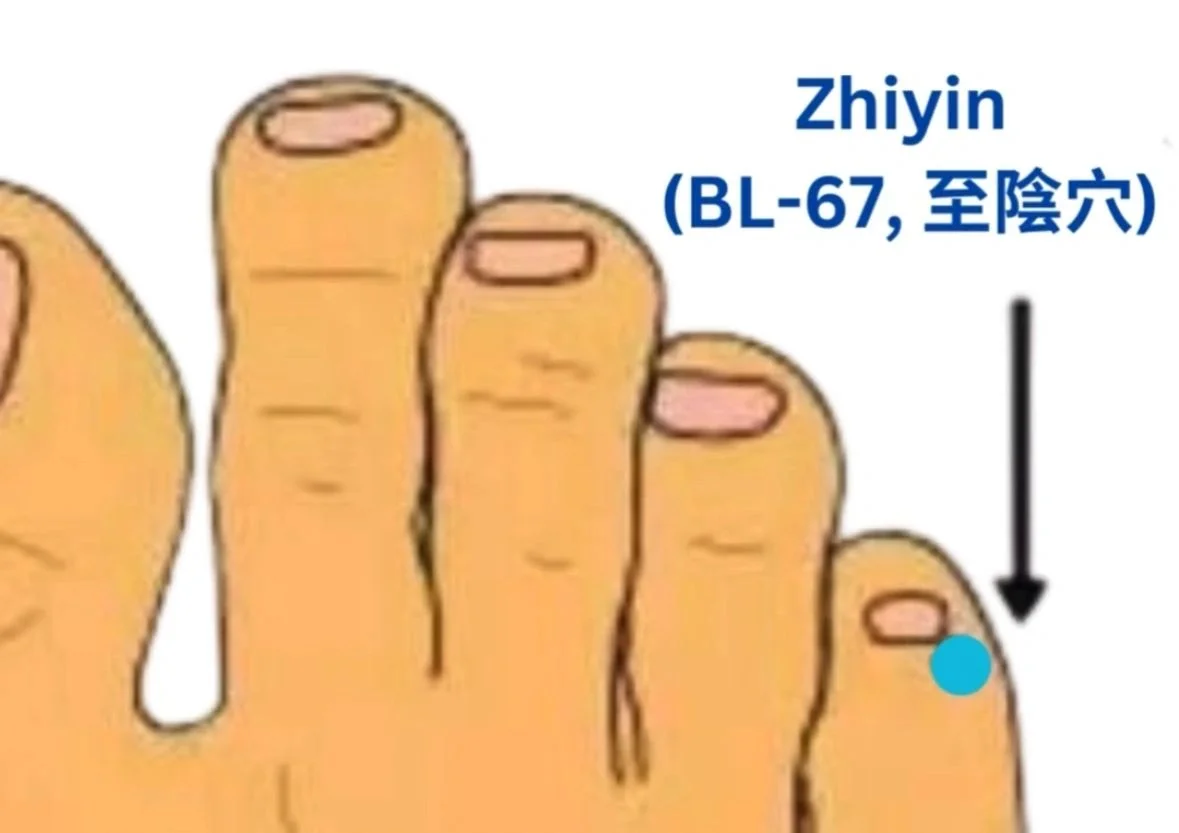 Zhiyin (BL-67, 至陰穴) 