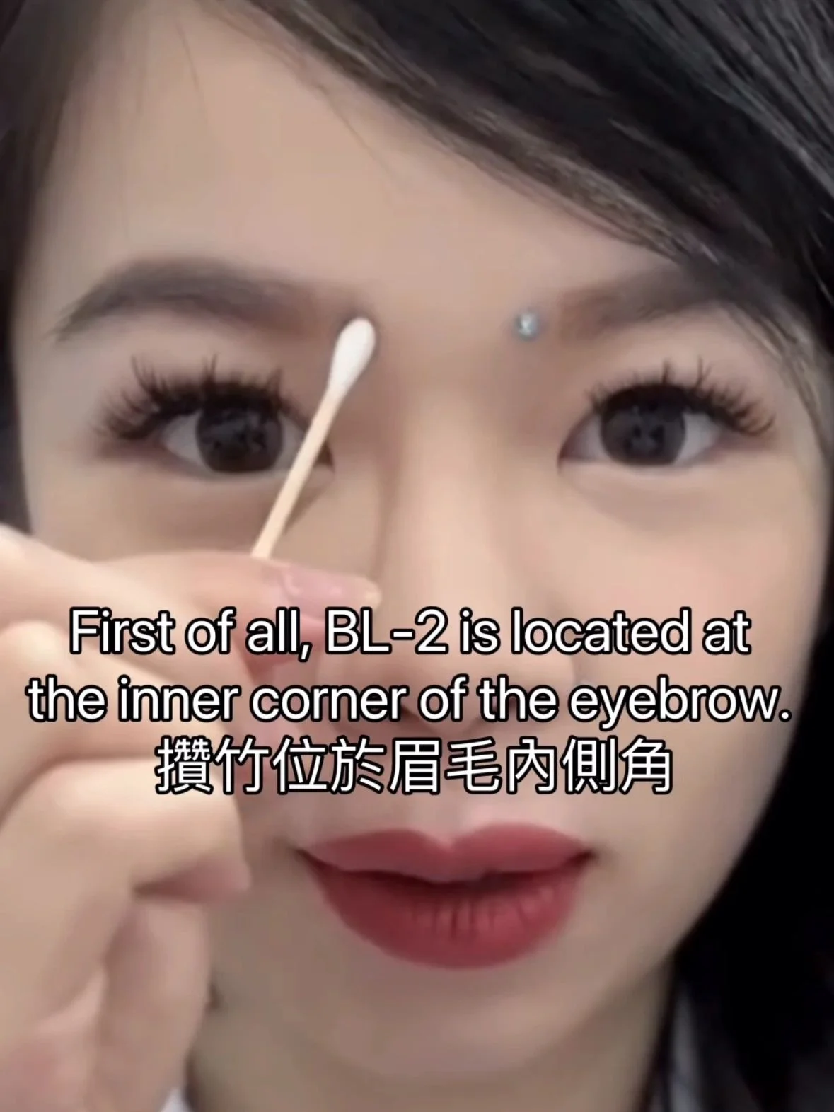 BL-2 (攢竹)